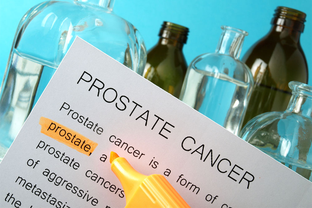 Causes and Risk Factors of Prostate Cancer