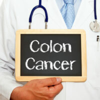 Early Symptoms of Colon Cancer