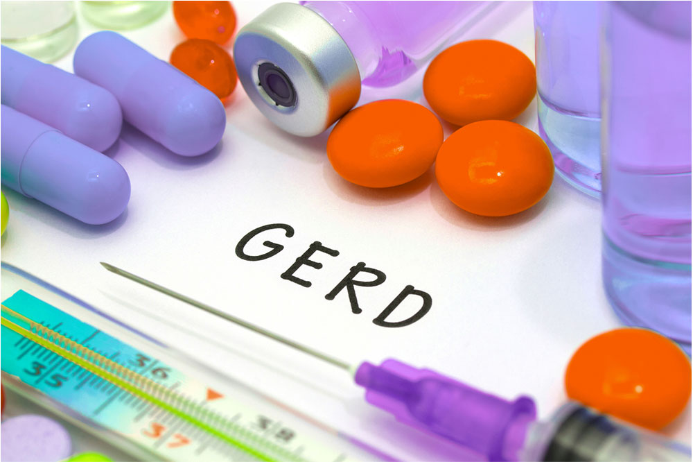 GERD Stages and Ways to Treat it