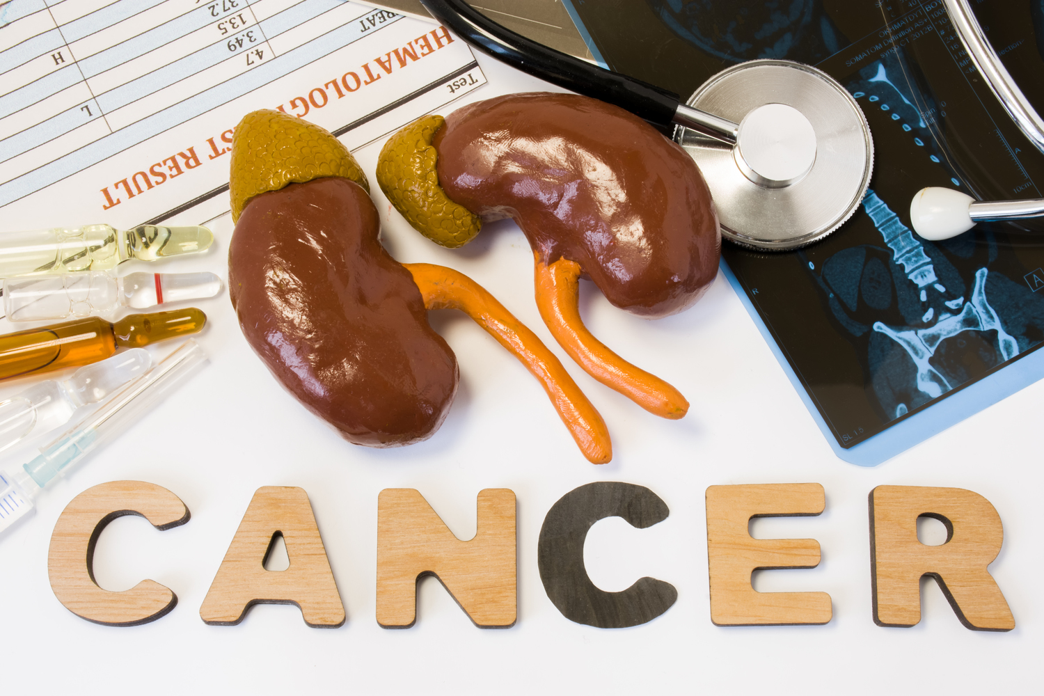 Early Symptoms Of Kidney Cancer